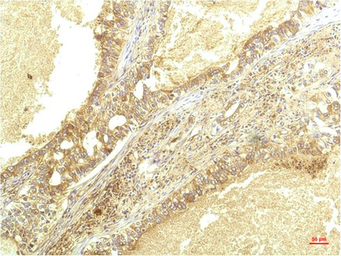 Anti-CXCL8 / IL8 antibody [8B1] used in IHC (Paraffin sections) (IHC-P). GTX34342
