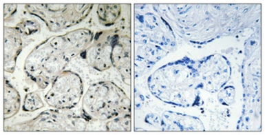 Anti-CYB5R3 antibody used in IHC (Paraffin sections) (IHC-P). GTX34344