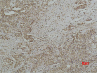 Anti-Cytochrome C antibody [4B10] used in IHC (Paraffin sections) (IHC-P). GTX34345
