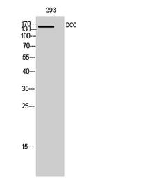 Anti-DCC antibody used in Western Blot (WB). GTX34348