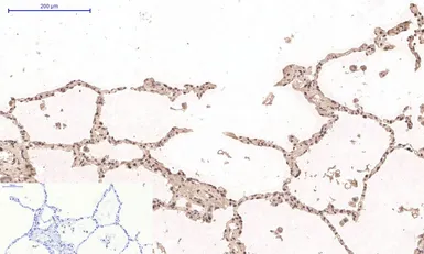 Anti-Desmin antibody [1B12] used in IHC (Paraffin sections) (IHC-P). GTX34350