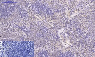 Anti-Desmin antibody [1B12] used in IHC (Paraffin sections) (IHC-P). GTX34350