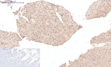 Anti-Desmin antibody [1B12] used in IHC (Paraffin sections) (IHC-P). GTX34350