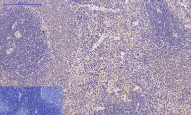 Anti-Desmin antibody [1B12] used in IHC (Paraffin sections) (IHC-P). GTX34350