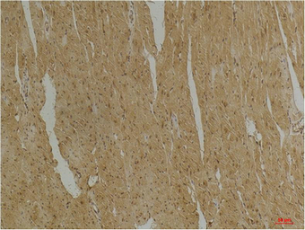 Anti-Desmin antibody [1B12] used in IHC (Paraffin sections) (IHC-P). GTX34350