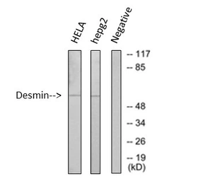 Anti-Desmin antibody [1B12] used in Western Blot (WB). GTX34350