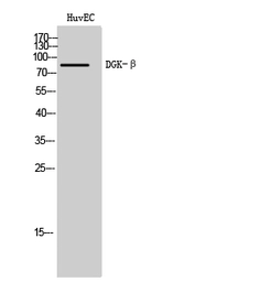 Anti-DGKB antibody used in Western Blot (WB). GTX34351