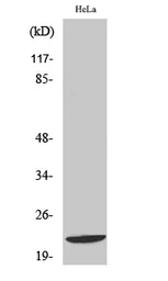 Anti-DIRAS1 antibody used in Western Blot (WB). GTX34354