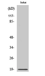 Anti-RCL antibody used in Western Blot (WB). GTX34356