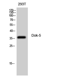 Anti-DOK5 antibody used in Western Blot (WB). GTX34357