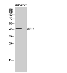 Anti-DUSP4 antibody used in Western Blot (WB). GTX34358