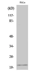 Anti-EID1 antibody used in Western Blot (WB). GTX34362
