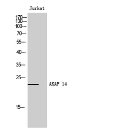 Anti-AKAP14 antibody used in Western Blot (WB). GTX34363