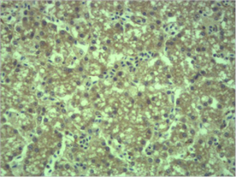 Anti-EPG5 antibody used in IHC (Paraffin sections) (IHC-P). GTX34365
