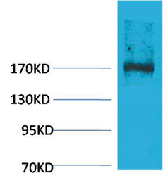 Anti-EPG5 antibody used in Western Blot (WB). GTX34365