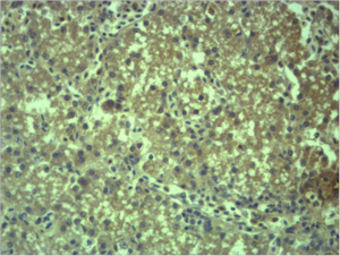 Anti-EPG5 antibody used in IHC (Paraffin sections) (IHC-P). GTX34366