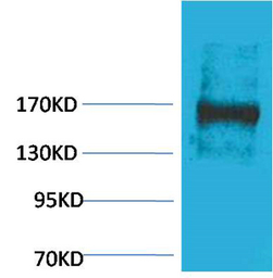 Anti-EPG5 antibody used in Western Blot (WB). GTX34366