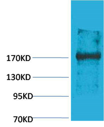 Anti-EPG5 antibody used in Western Blot (WB). GTX34367