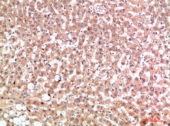 Anti-EPG5 antibody used in IHC (Paraffin sections) (IHC-P). GTX34368