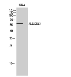 Anti-ALS2CR13 antibody used in Western Blot (WB). GTX34371
