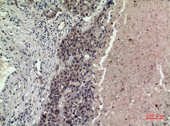 Anti-FGF16 antibody used in IHC (Paraffin sections) (IHC-P). GTX34376