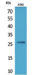 Anti-FGF16 antibody used in Western Blot (WB). GTX34376