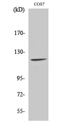 Anti-FUK antibody used in Western Blot (WB). GTX34382