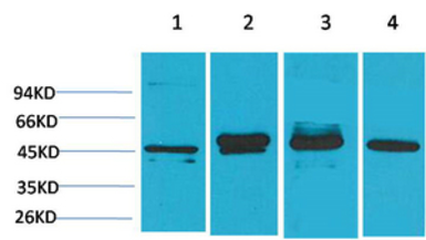 Anti-GAP43 antibody [Mix] used in Western Blot (WB). GTX34384