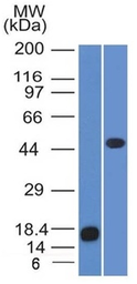 Anti-ADFP antibody [ADFP/1365] used in Western Blot (WB). GTX34395
