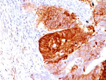 Anti-ALDH1A1 antibody [ALDH1A1/1381] used in IHC (Paraffin sections) (IHC-P). GTX34400