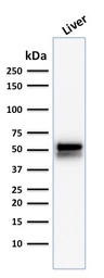 Anti-ALDH1A1 antibody [ALDH1A1/1381] used in Western Blot (WB). GTX34400