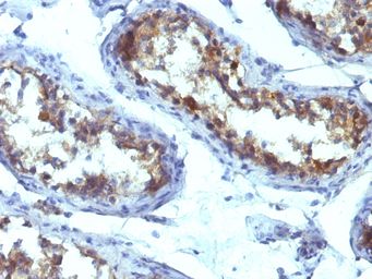 Anti-Alkaline Phosphatase (Tissue Non-Specific) antibody [ALPL/597] used in IHC (Paraffin sections) (IHC-P). GTX34402