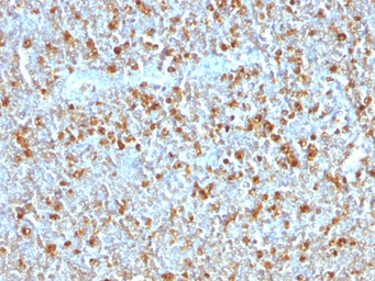 Anti-alpha 1 Antitrypsin antibody [AAT/1379] used in IHC (Paraffin sections) (IHC-P). GTX34404