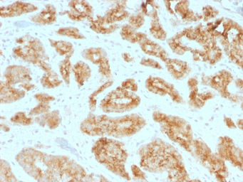 Anti-AMACR antibody [AMACR/1723] used in IHC (Paraffin sections) (IHC-P). GTX34410