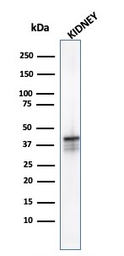 Anti-AMACR antibody [AMACR/1723] used in Western Blot (WB). GTX34410
