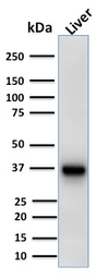 Anti-AMACR antibody [AMACR/1723] used in Western Blot (WB). GTX34410