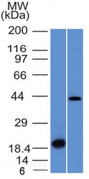 Anti-Aurora B antibody [AURKB/1521] used in Western Blot (WB). GTX34419