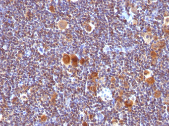 Anti-Bax antibody [SPM336] used in IHC (Paraffin sections) (IHC-P). GTX34420