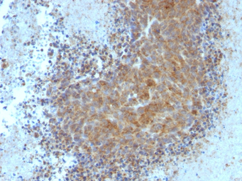 Anti-Bax antibody [BAX/962] used in IHC (Paraffin sections) (IHC-P). GTX34421