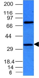 Anti-BCL10 antibody [BL10/411] used in Western Blot (WB). GTX34423