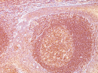 Anti-BCL10 antibody [SPM520] used in IHC (Paraffin sections) (IHC-P). GTX34424