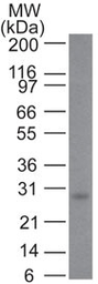 Anti-Bcl-2 antibody [100/D5] used in Western Blot (WB). GTX34425