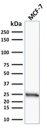Anti-Bcl-2 antibody [100/D5] used in Western Blot (WB). GTX34425
