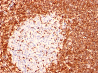 Anti-Bcl-2 antibody [8C8] used in IHC (Paraffin sections) (IHC-P). GTX34427