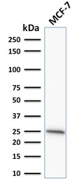 Anti-Bcl-2 antibody [SPM530] used in Western Blot (WB). GTX34428