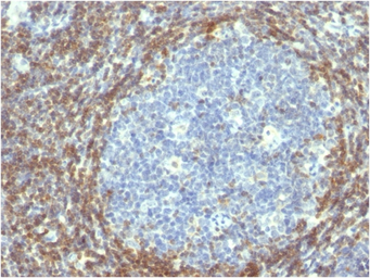 Anti-Bcl-2 antibody [BCL2/782] used in IHC (Paraffin sections) (IHC-P). GTX34429