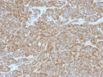 Anti-Bcl-2 antibody [BCL2/796] used in IHC (Paraffin sections) (IHC-P). GTX34430