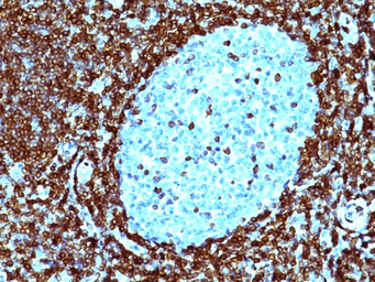 Anti-Bcl-2 antibody [124] used in IHC (Paraffin sections) (IHC-P). GTX34431