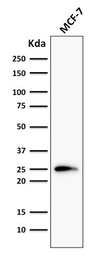 Anti-Bcl-2 antibody [124] used in Western Blot (WB). GTX34431