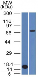 Anti-BCL6 antibody [BCL6/1475] used in Western Blot (WB). GTX34432